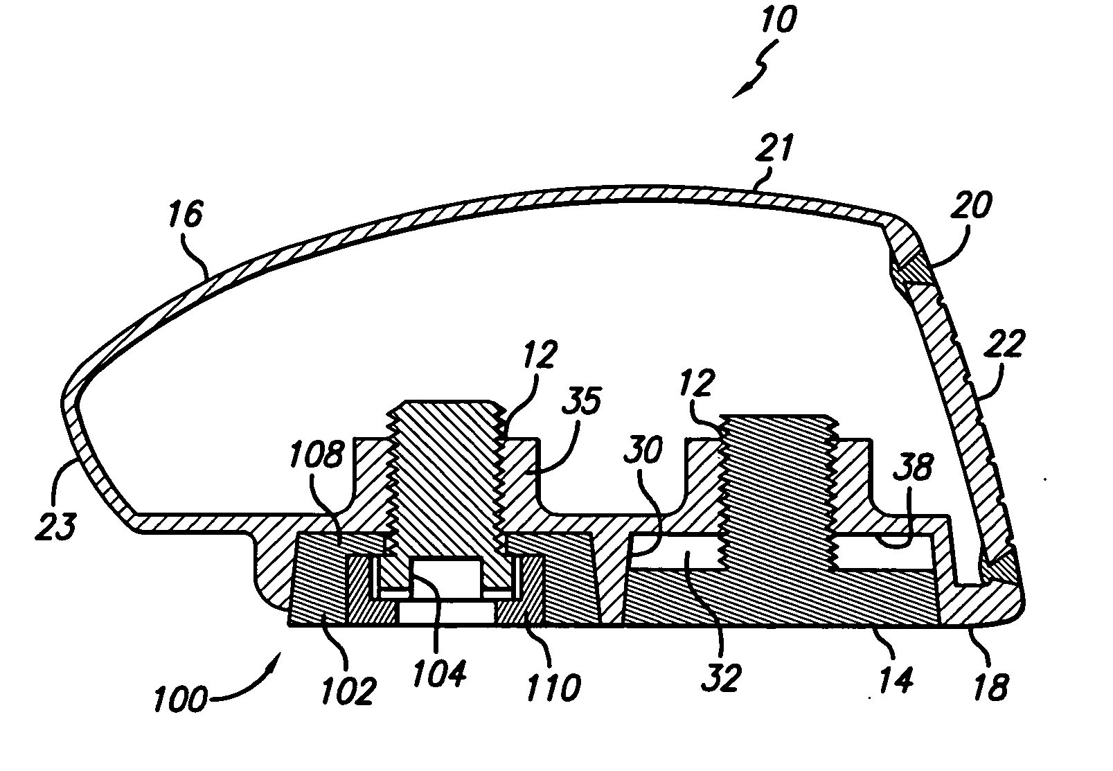 Golf club head having removable weight