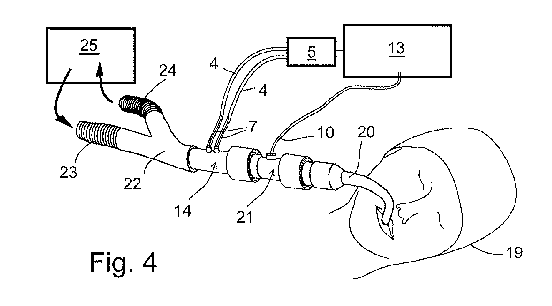 Arrangement for improving accuracy of pressure measurement and flow sensor