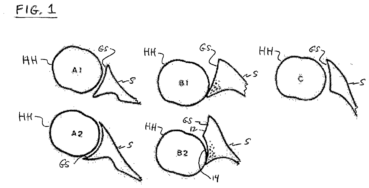 Shoulder patient specific instrument