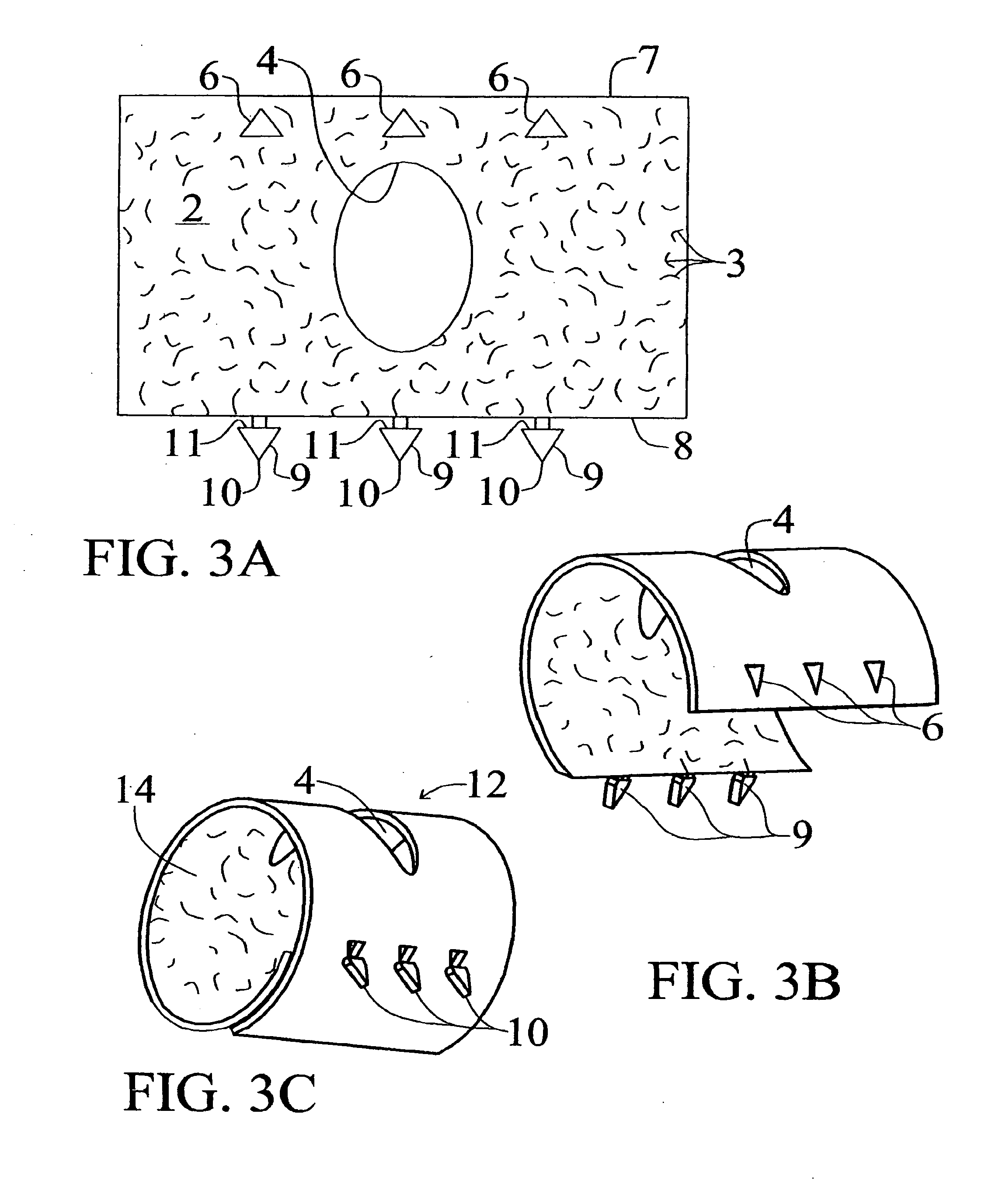 Medical Implants and Methods for Regulating the Tissue Response to Vascular Closure Devices