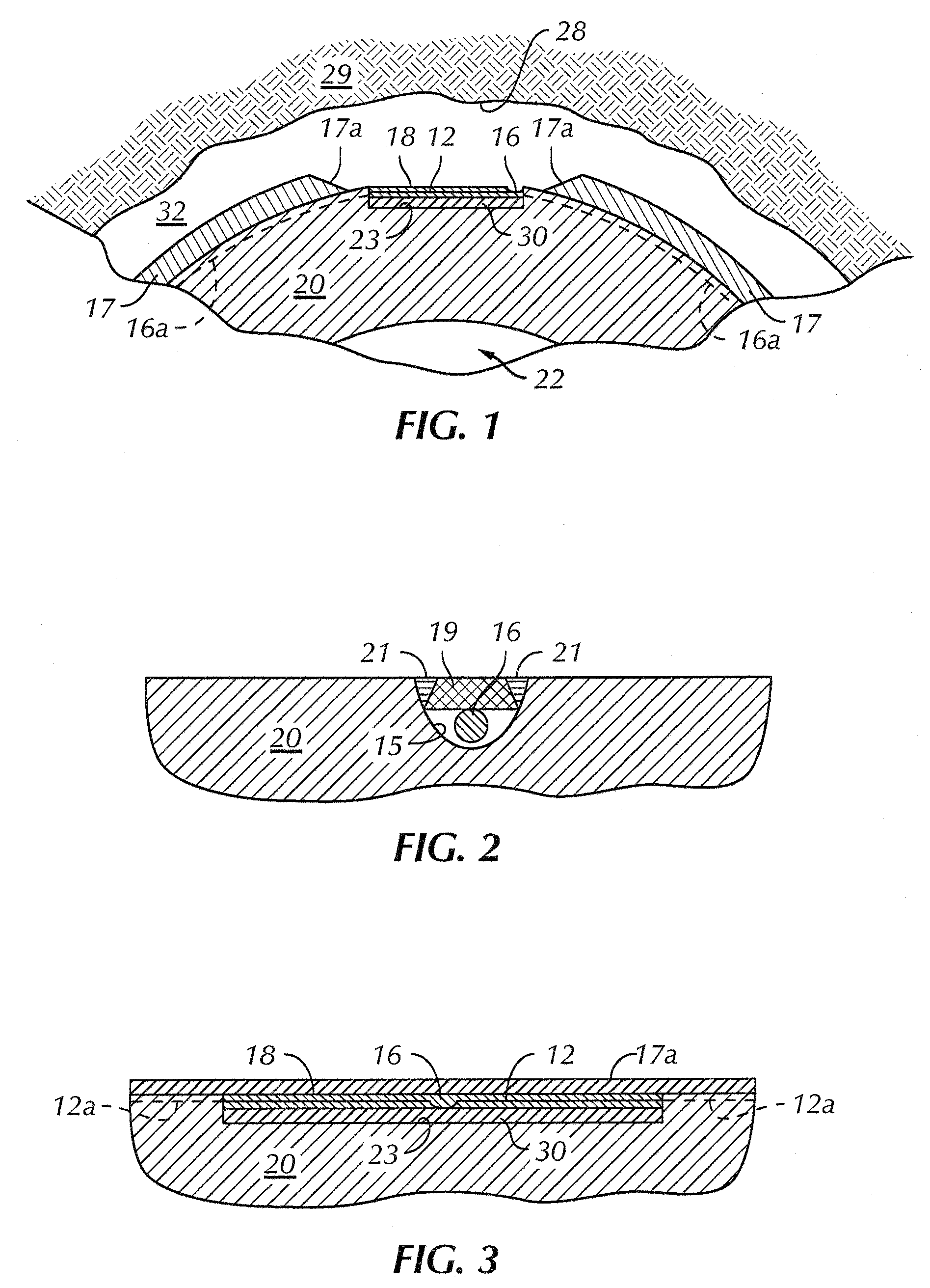 Array antenna for measurement-while-drilling