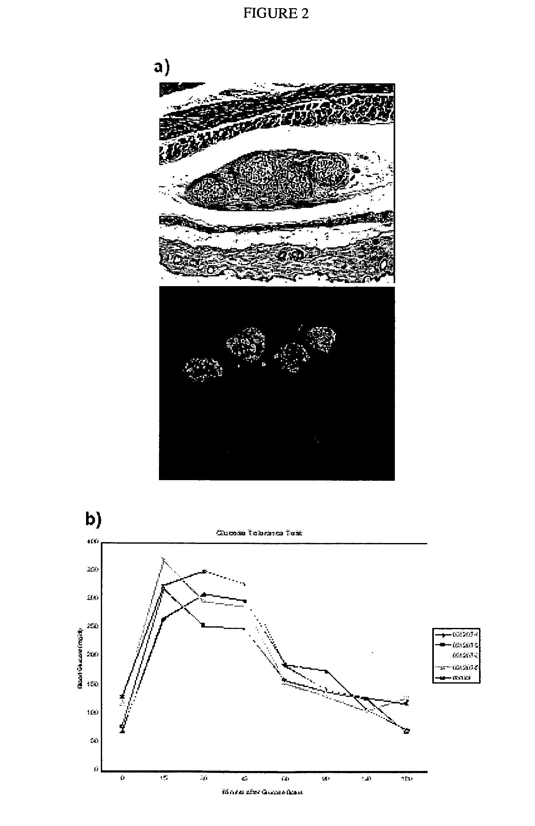 Pancreatic islet cells composition and methods