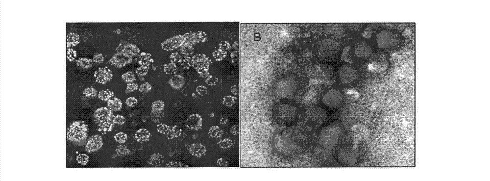 Entire gene sequence of severe fever with thrombocytopenia syndrome virus (SFTSV) and application