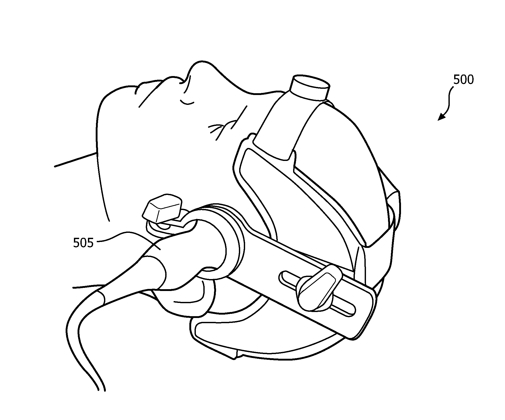 System and method for ultrasound and computed tomography image registration for sonothrombolysis treatment