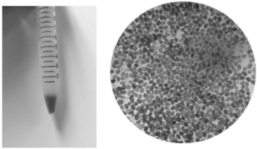 Schistosoma japonicum infection, and application of components of schistosoma japonicum to prevention and treatment of human tumors