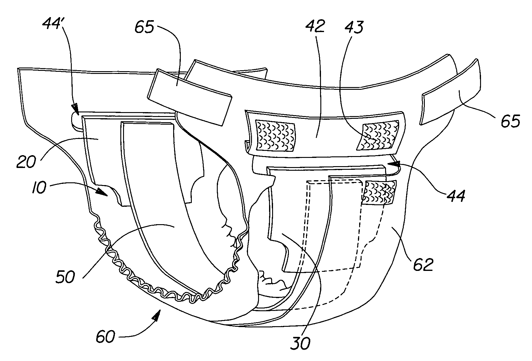 Absorbent articles having removable components