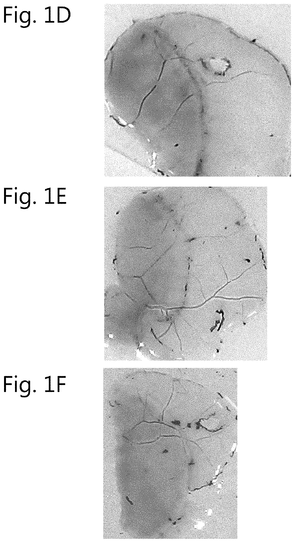 Ophthalmic dye composition