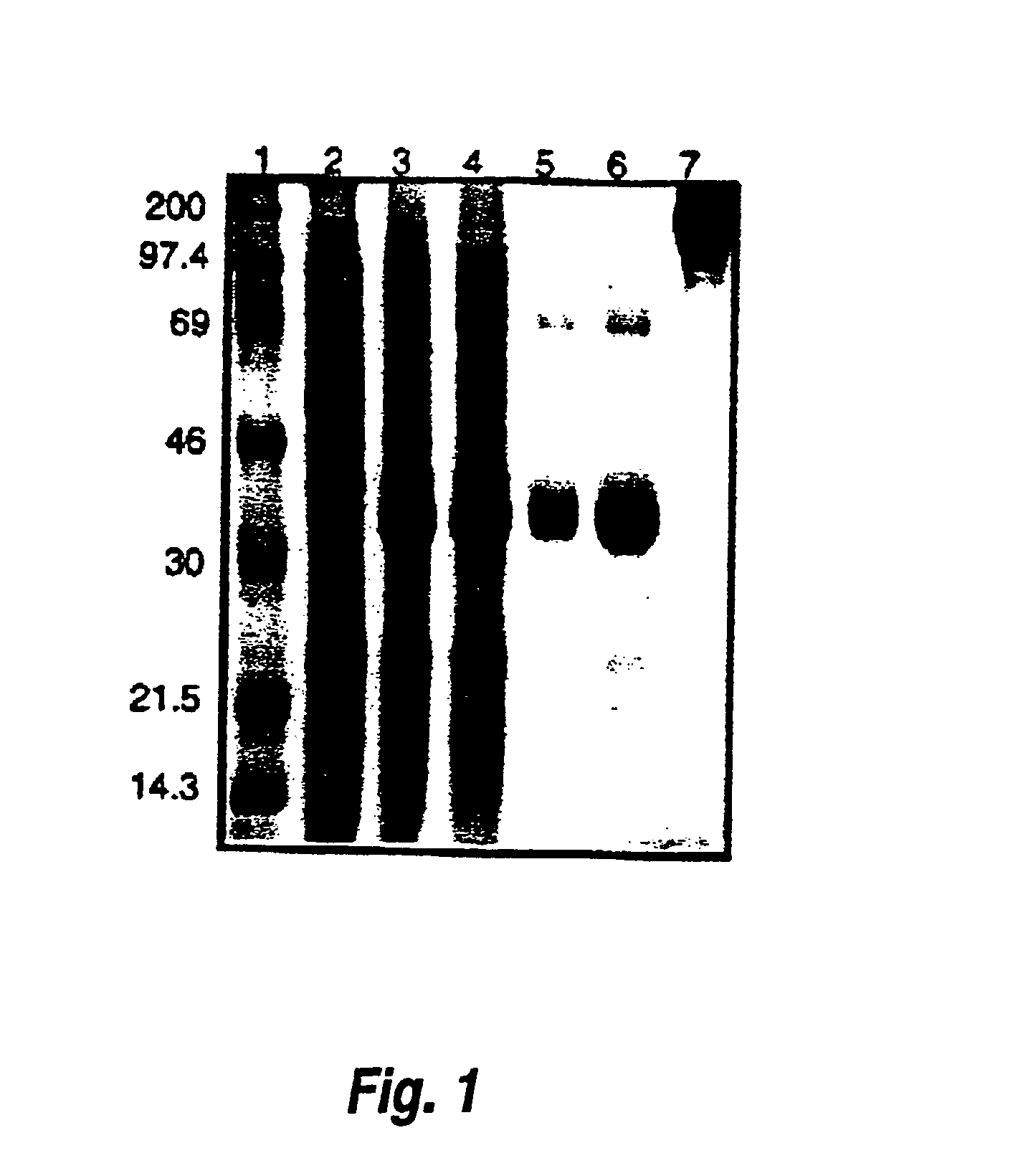 Urate oxidase