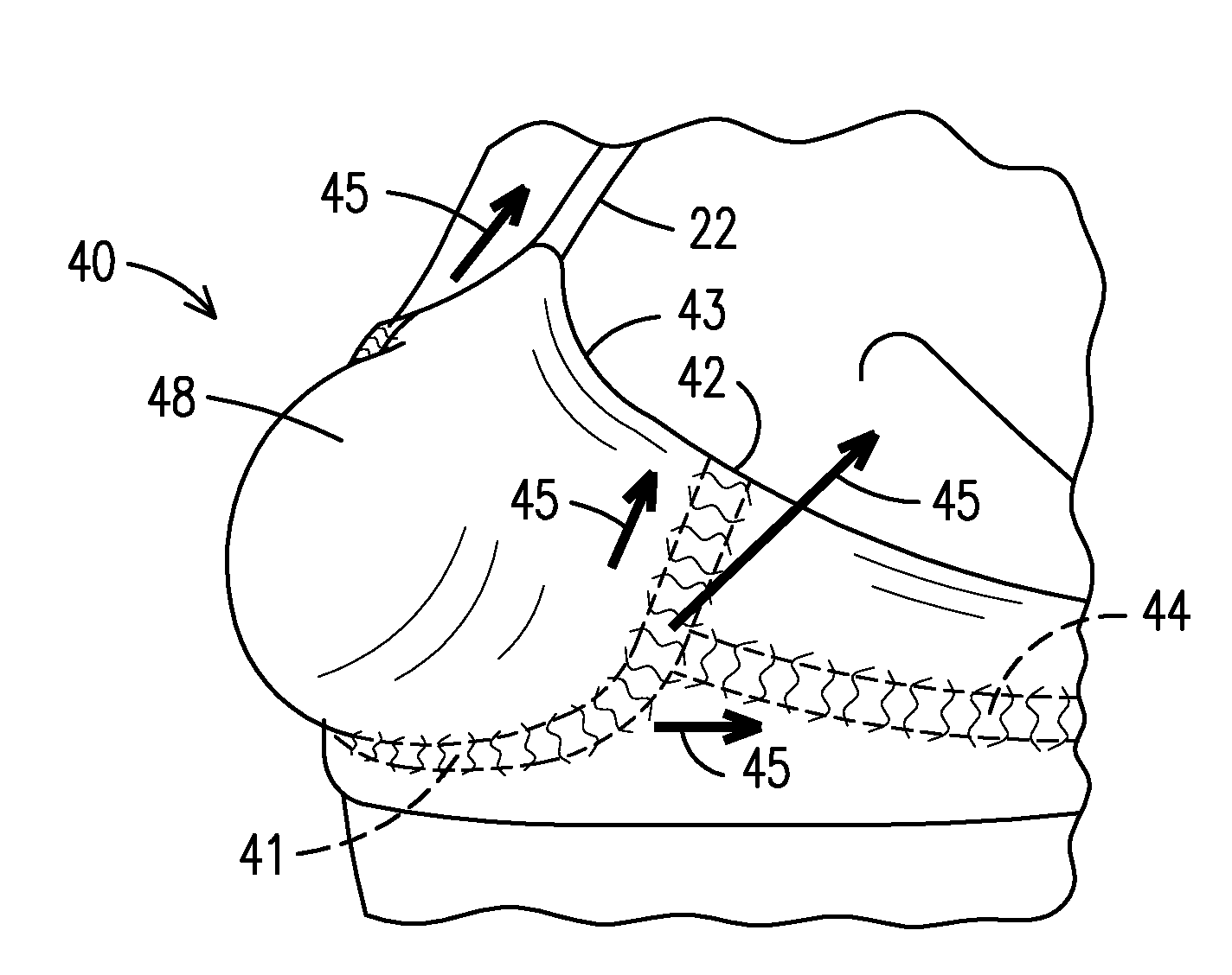 Breast shaping and lifting support garment