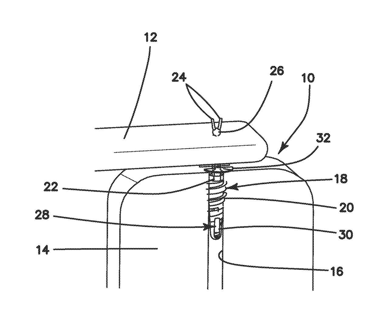 Systems and methods for repairing soft tissues using nanofiber material