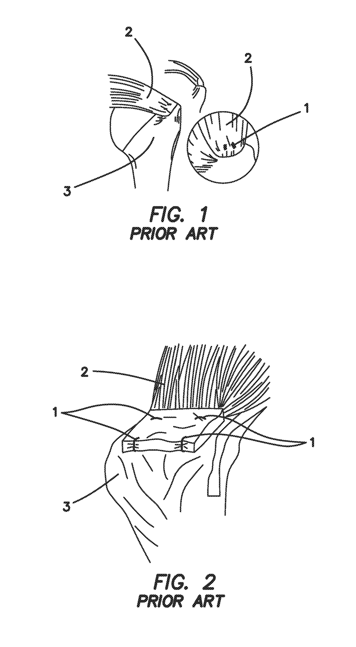 Systems and methods for repairing soft tissues using nanofiber material