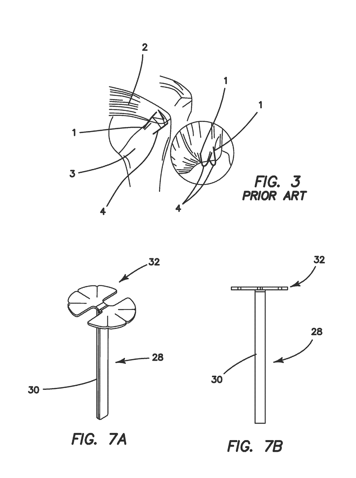 Systems and methods for repairing soft tissues using nanofiber material