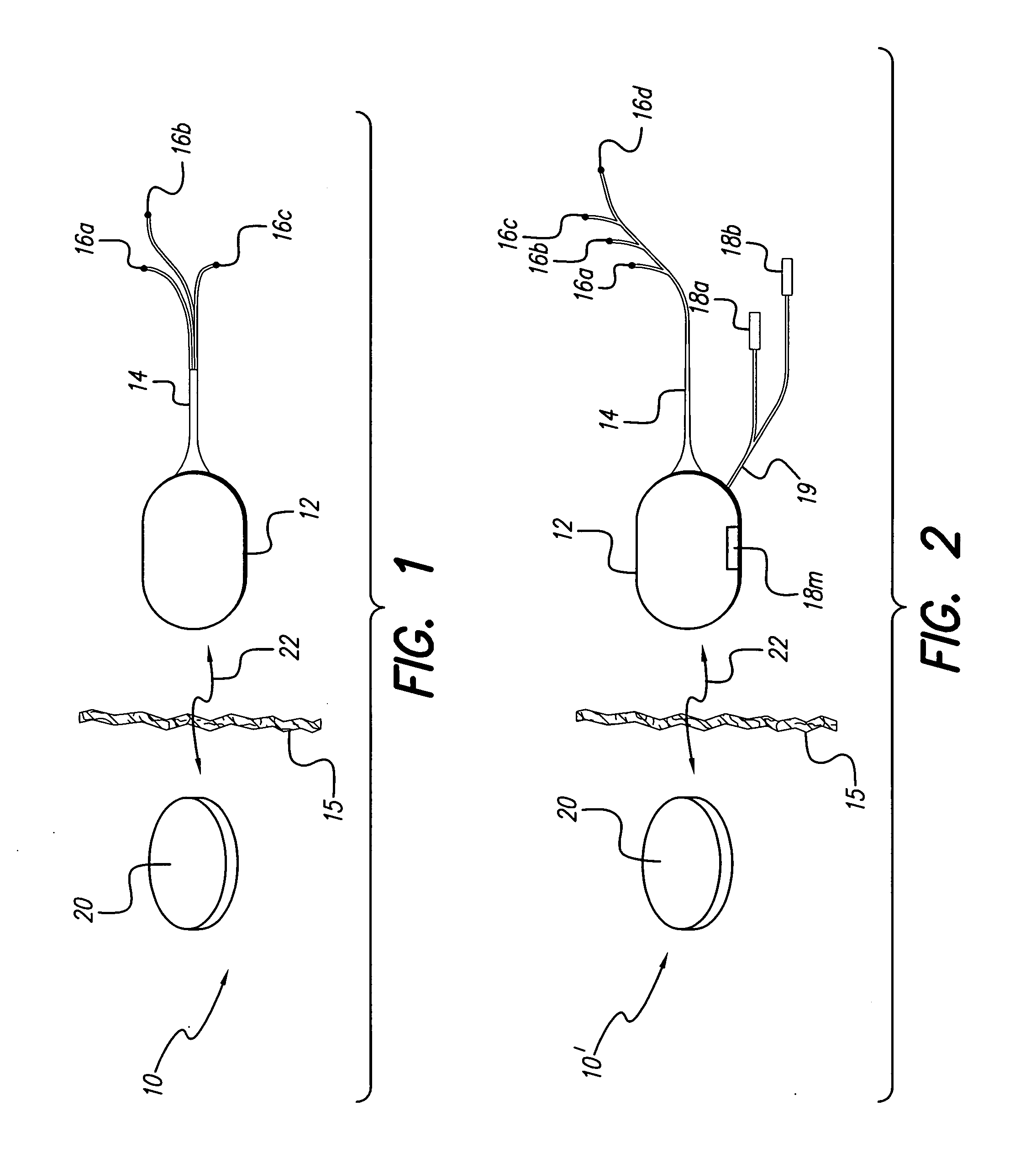 Programmable implantable pump with accessory reservoirs and multiple independent lumen catheter