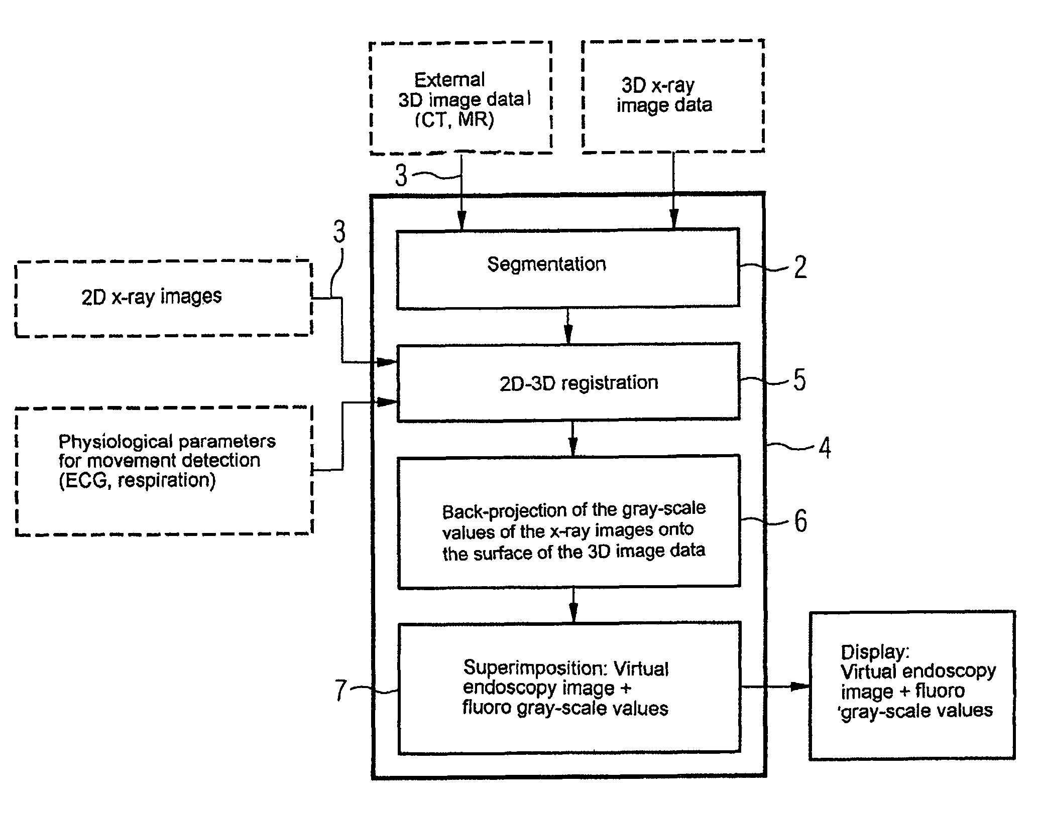 Device for merging a 2D radioscopy image with an image from a 3D image data record