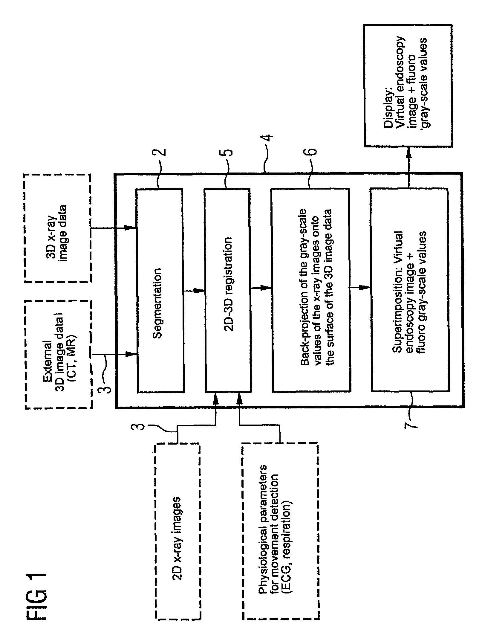 Device for merging a 2D radioscopy image with an image from a 3D image data record