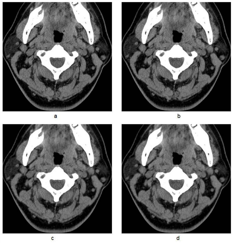 CT image reconstruction method based on non-cylindrical detector and CT scanner