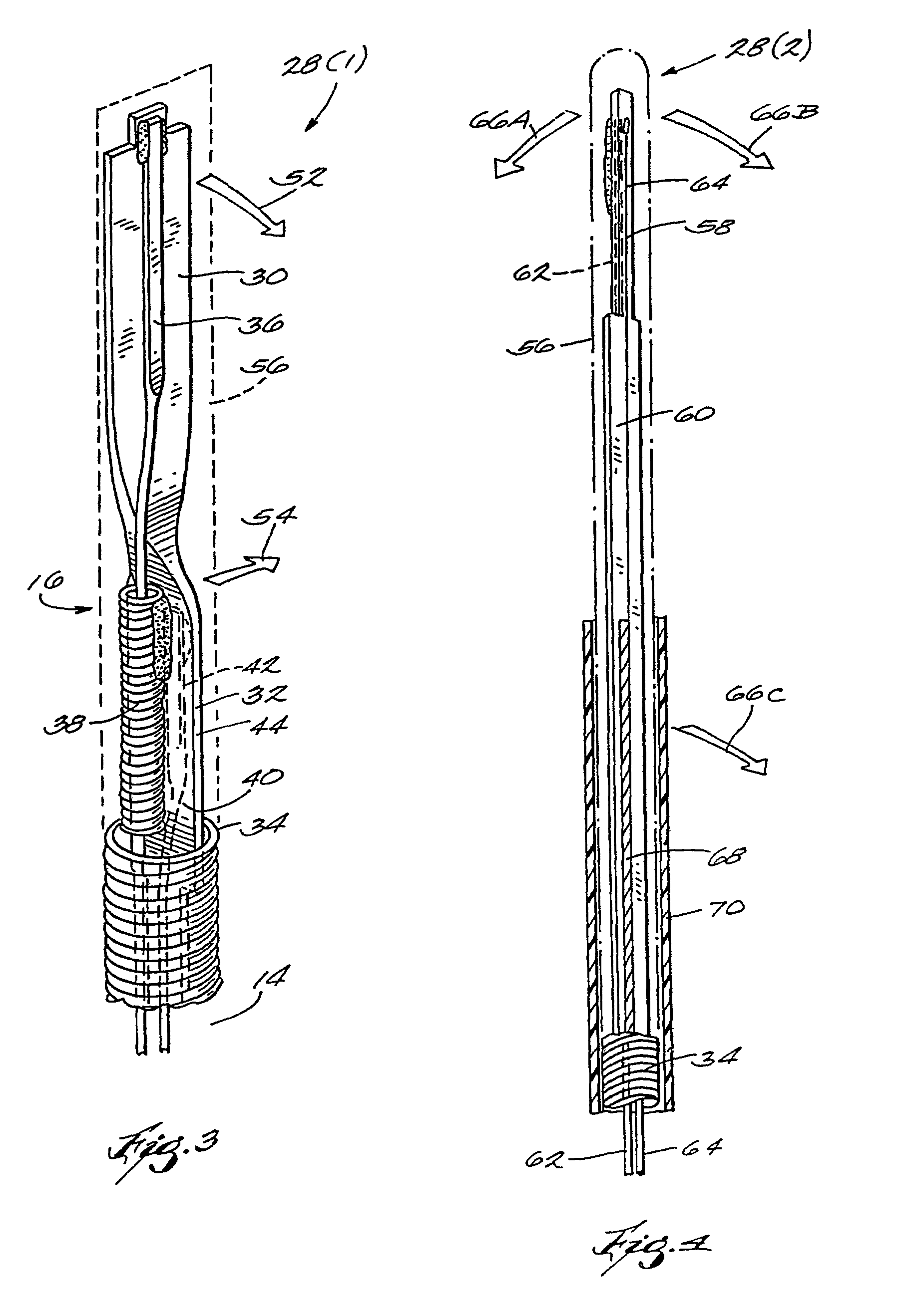 Assemblies for creating compound curves in distal catheter regions