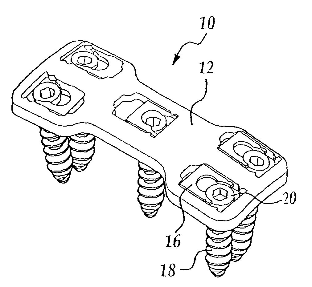 Bone plate and screw retaining mechanism