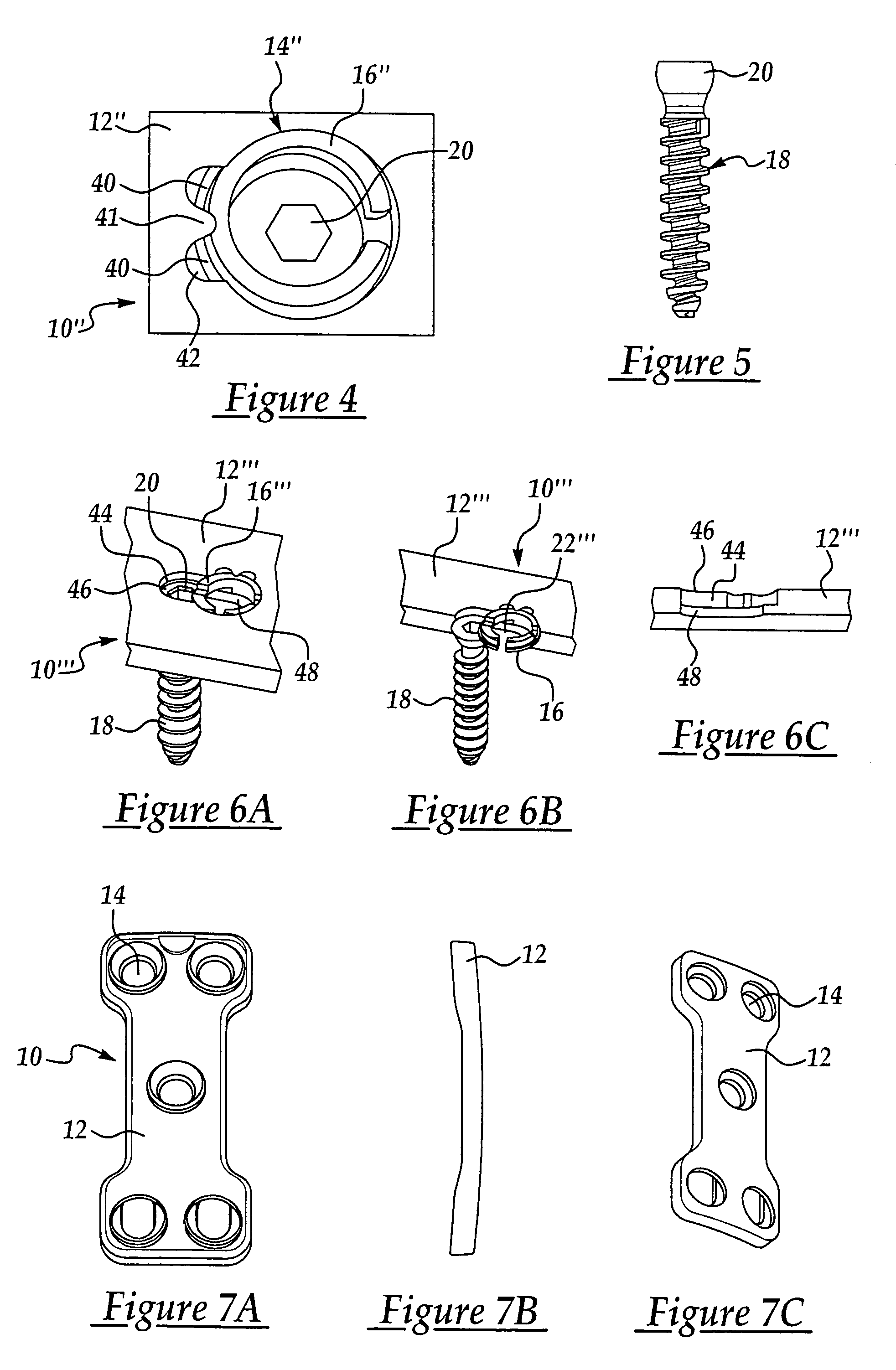 Bone plate and screw retaining mechanism