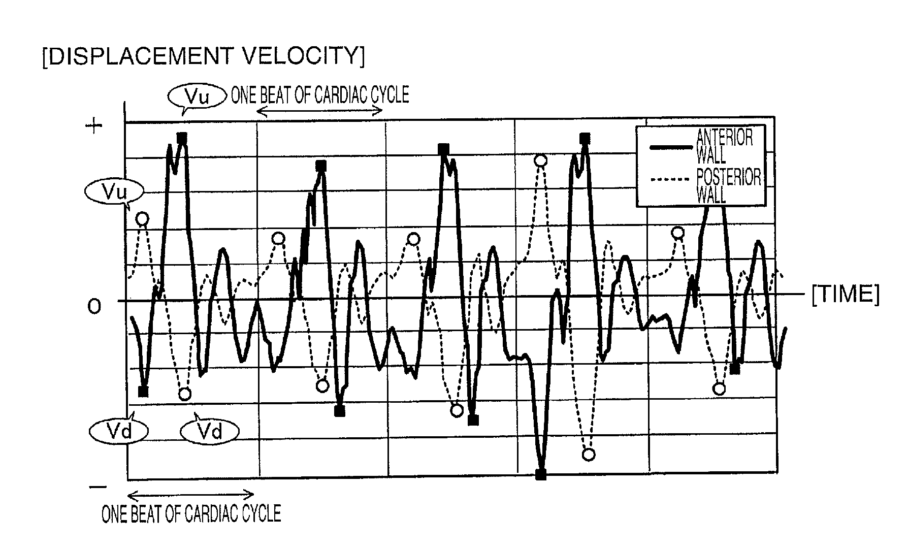 Ultrasound measurement apparatus and ultrasound measurement method