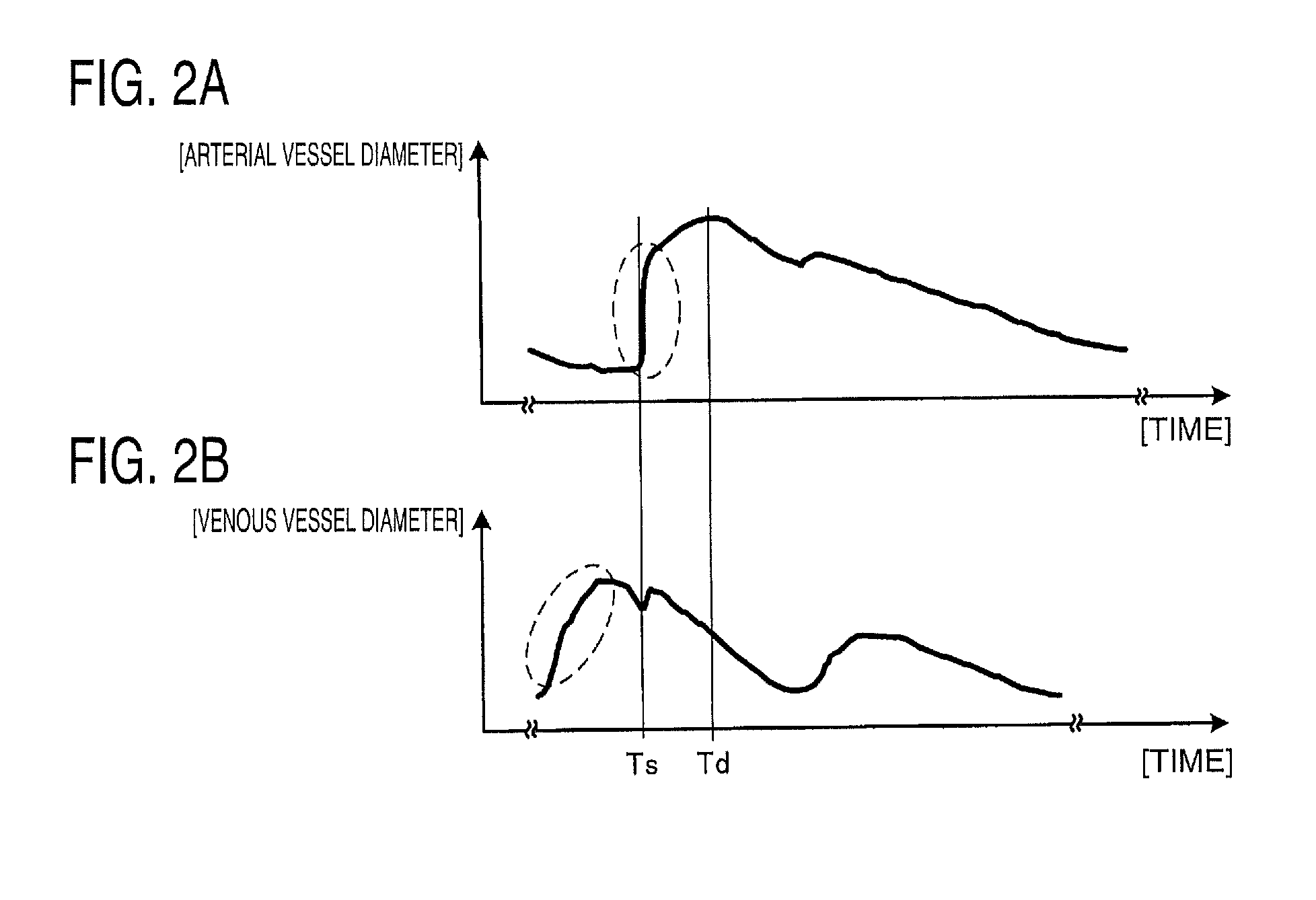 Ultrasound measurement apparatus and ultrasound measurement method