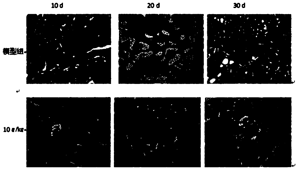 Phellinus igniarius fruit body extract product, and applications thereof in preparation of drugs for treating chronic renal failure