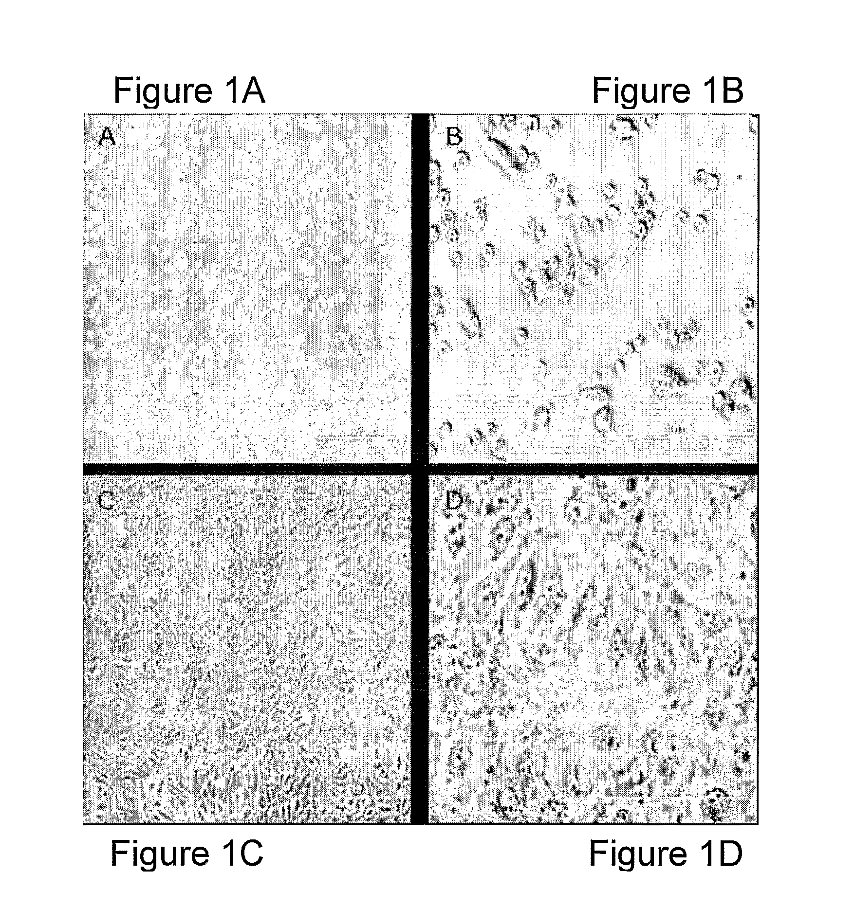 Methods for bone regeneration using endothelial progenitor cell preparations