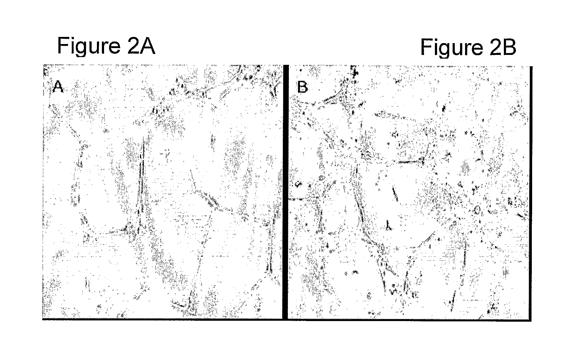 Methods for bone regeneration using endothelial progenitor cell preparations