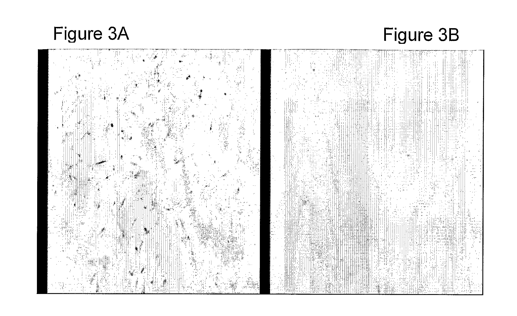 Methods for bone regeneration using endothelial progenitor cell preparations