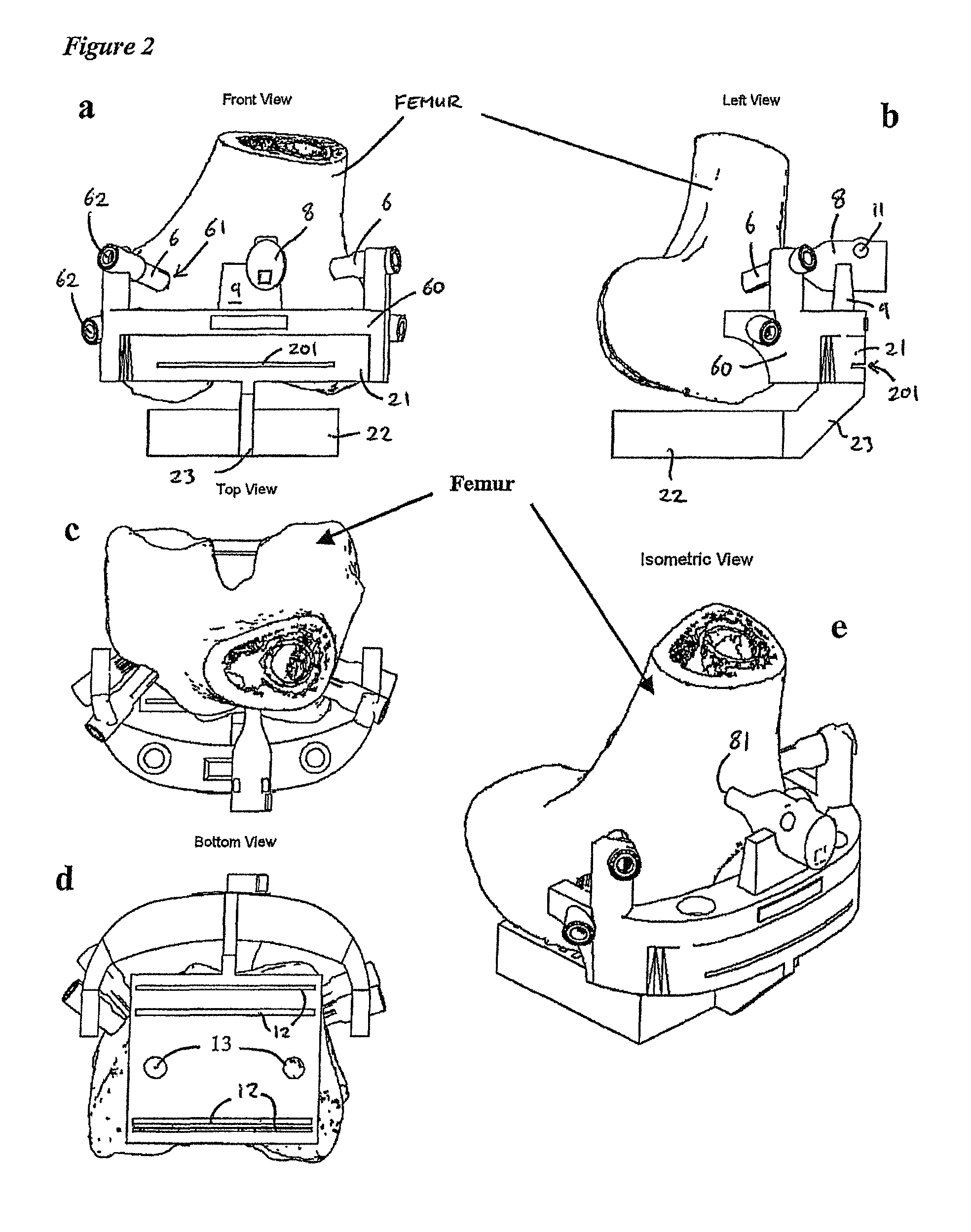 Surgical templates