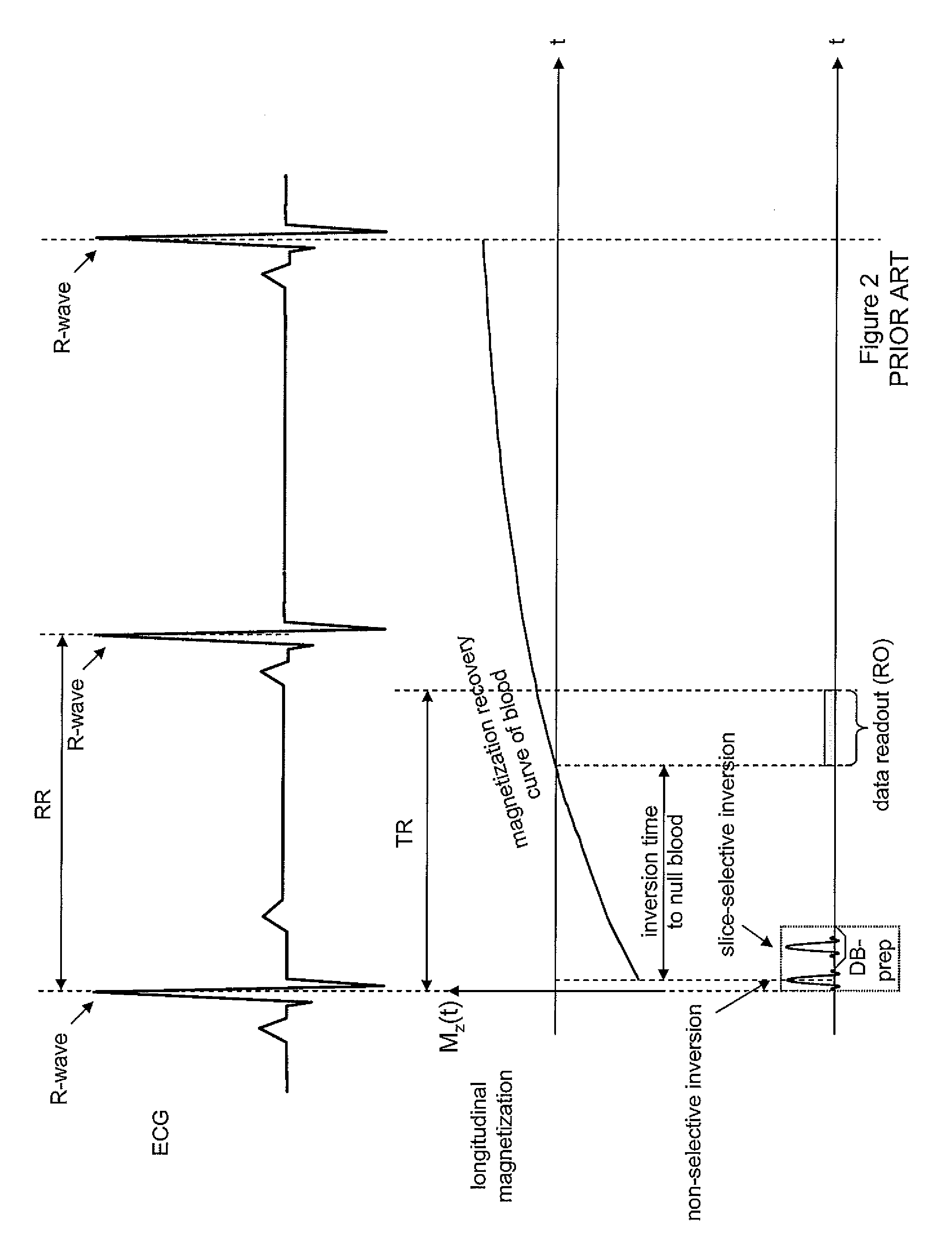 System for automated parameter setting in cardiac magnetic resonance imaging