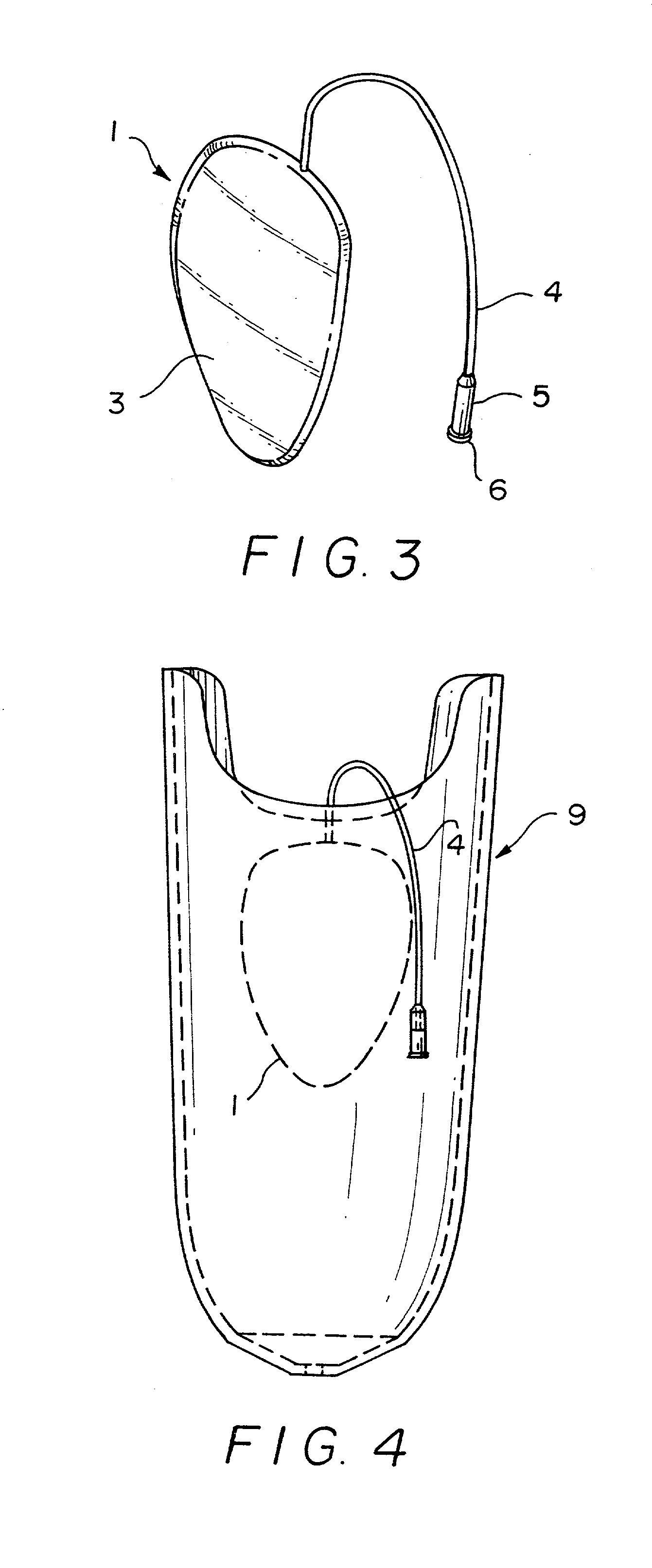 Artificial limb socket containing volume control pad