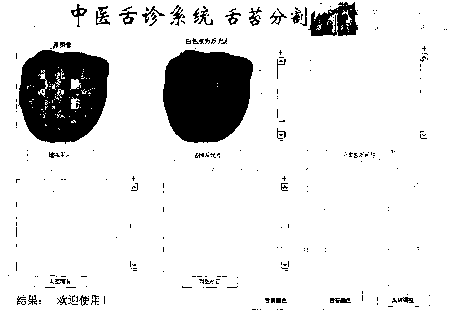 Coated tongue division and extracting method for colored digital photo of tongue