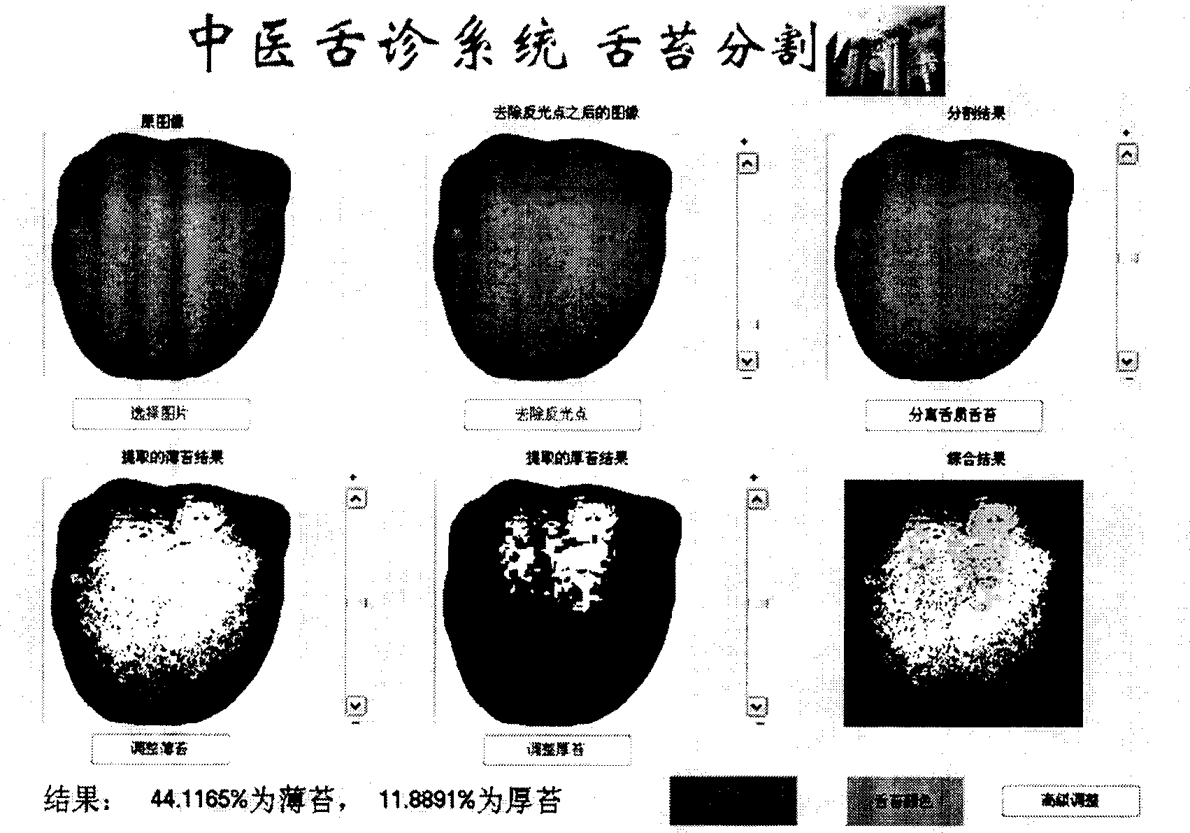 Coated tongue division and extracting method for colored digital photo of tongue