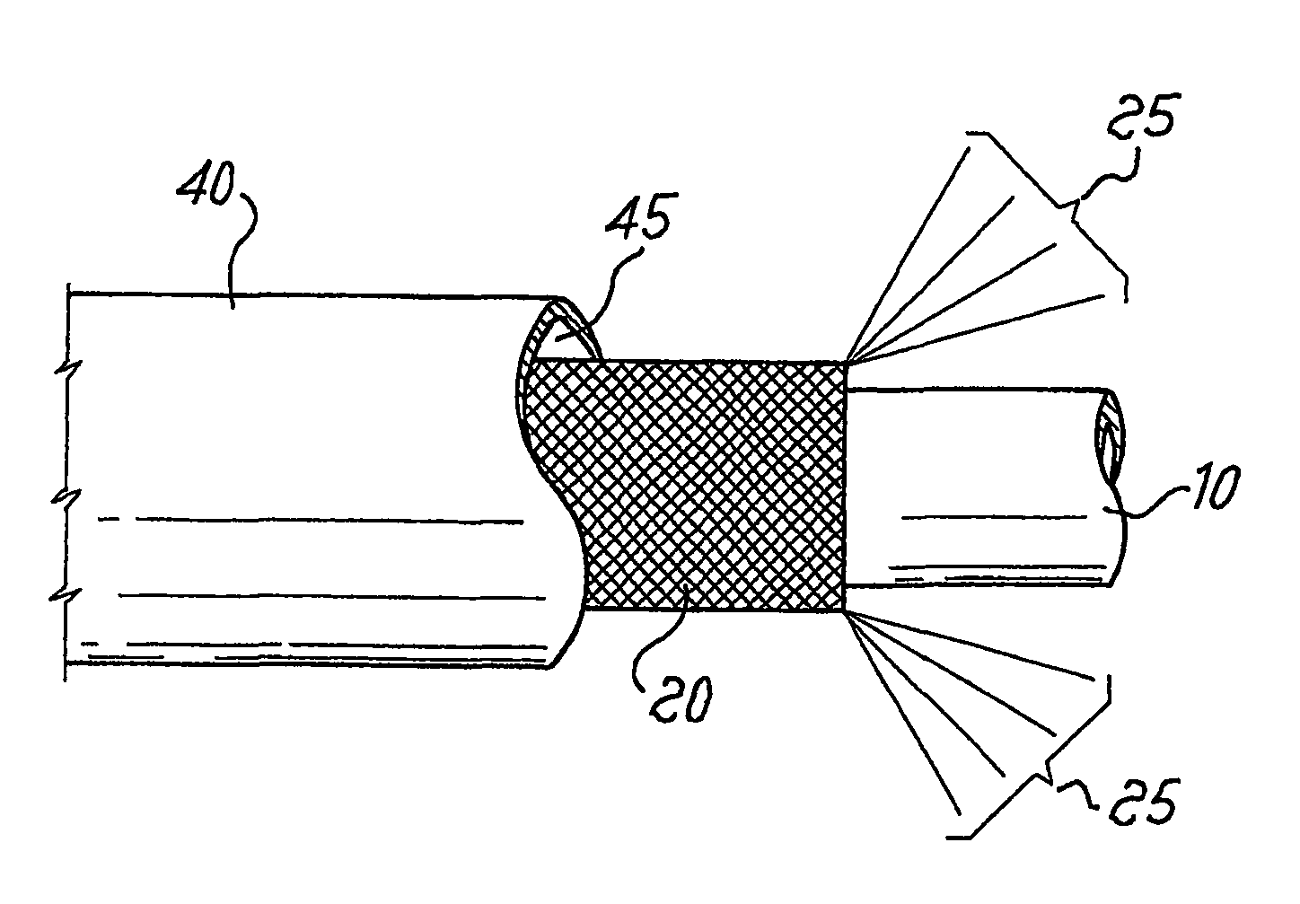 Chromatography column assembly with woven tubular mesh heater element