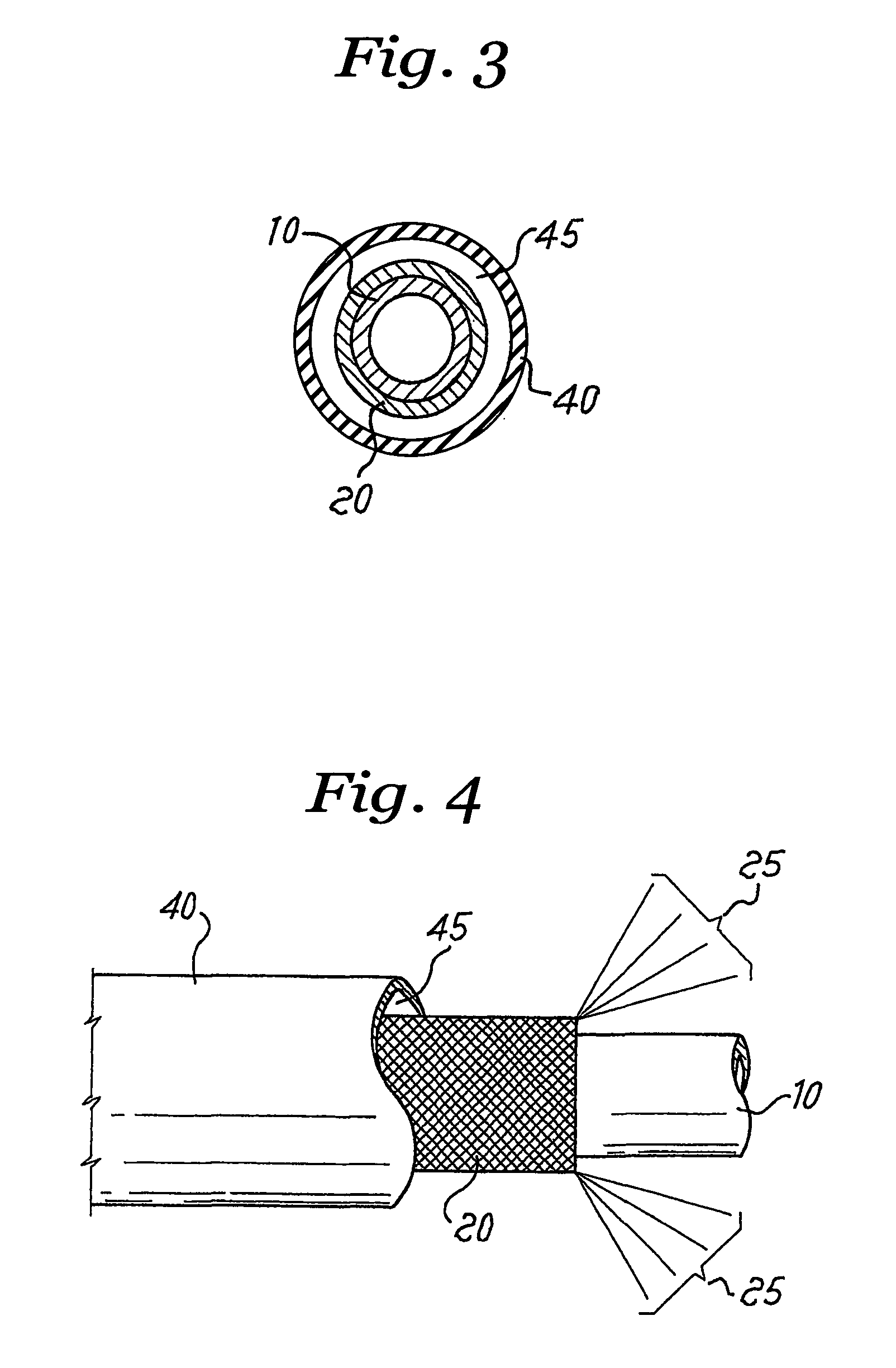 Chromatography column assembly with woven tubular mesh heater element