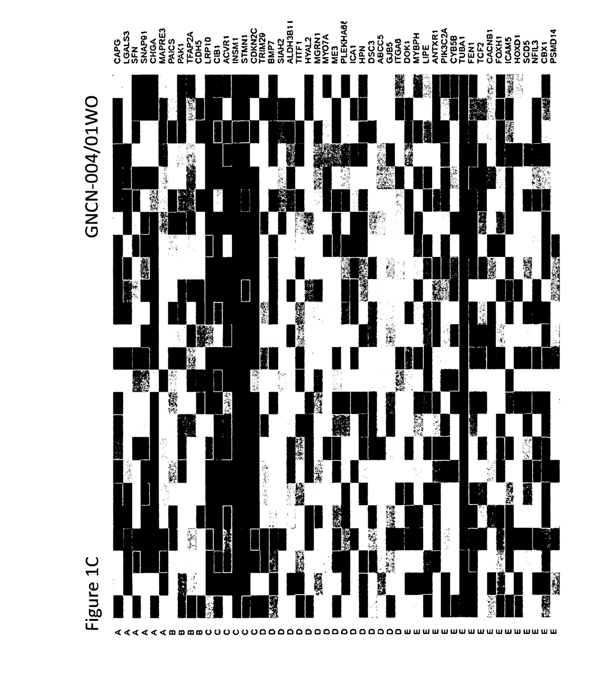 Methods for typing of lung cancer