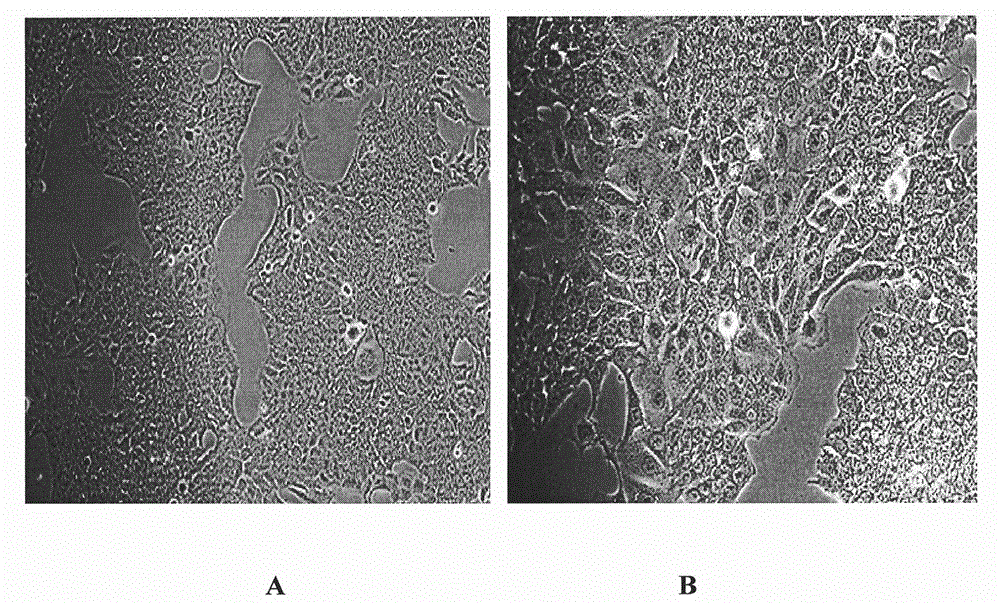 A strain of endometrial adenocarcinoma cell lines