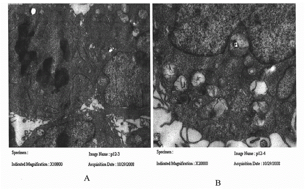 A strain of endometrial adenocarcinoma cell lines