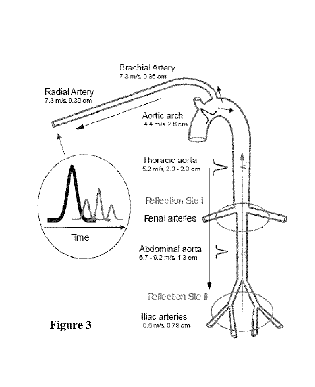 Detection of progressive central hypovolemia