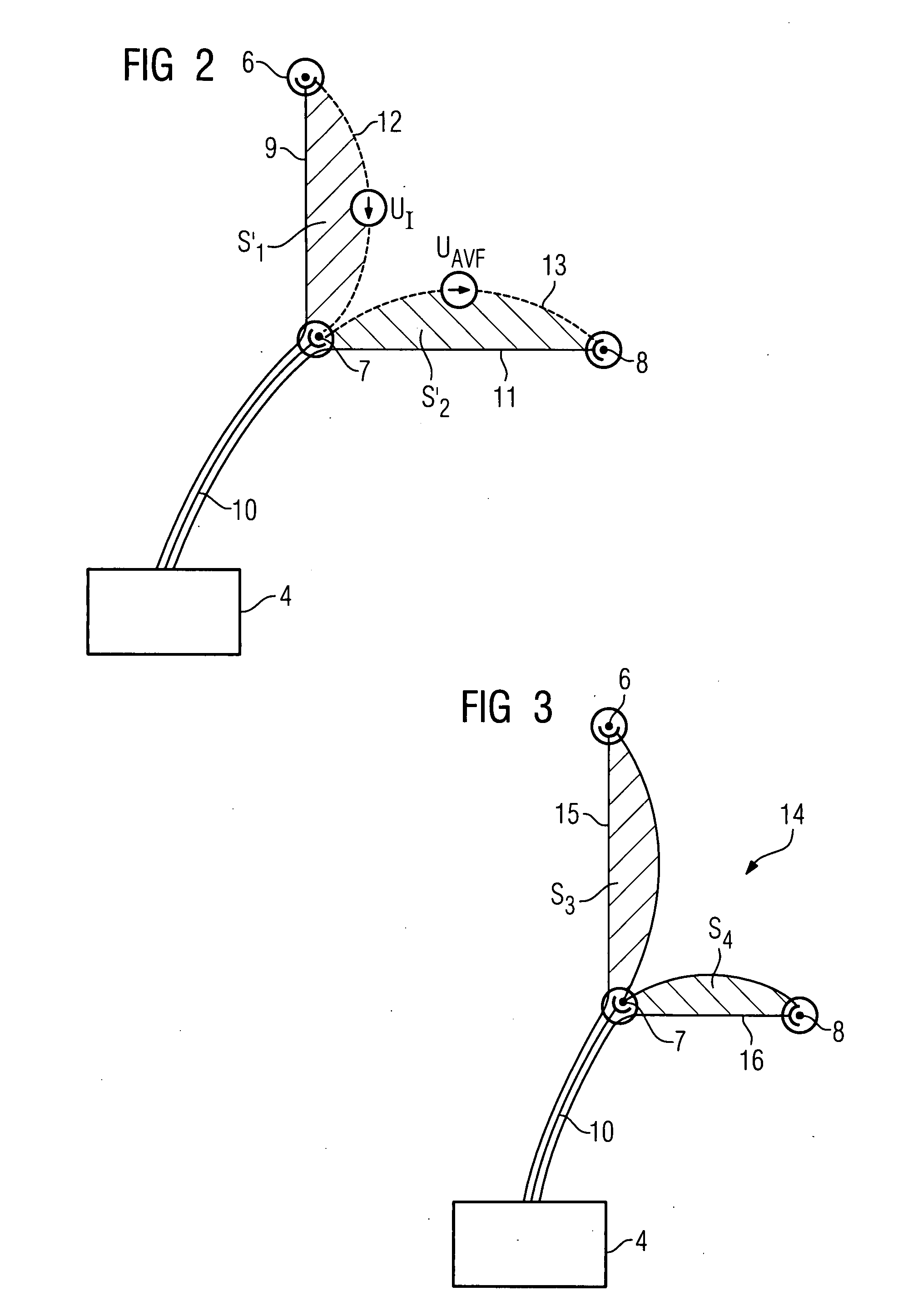 Arrangement for recording ECG signals