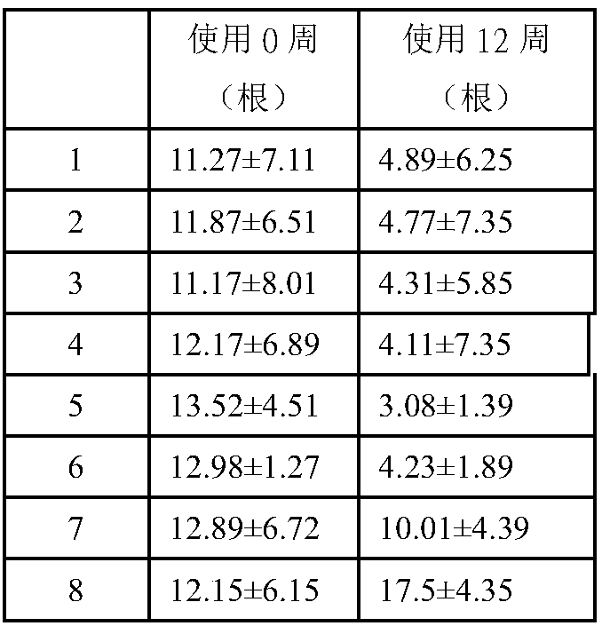 Composition for preventing hair loss and application thereof, and hair-loss-preventing product containing composition and preparation method thereof