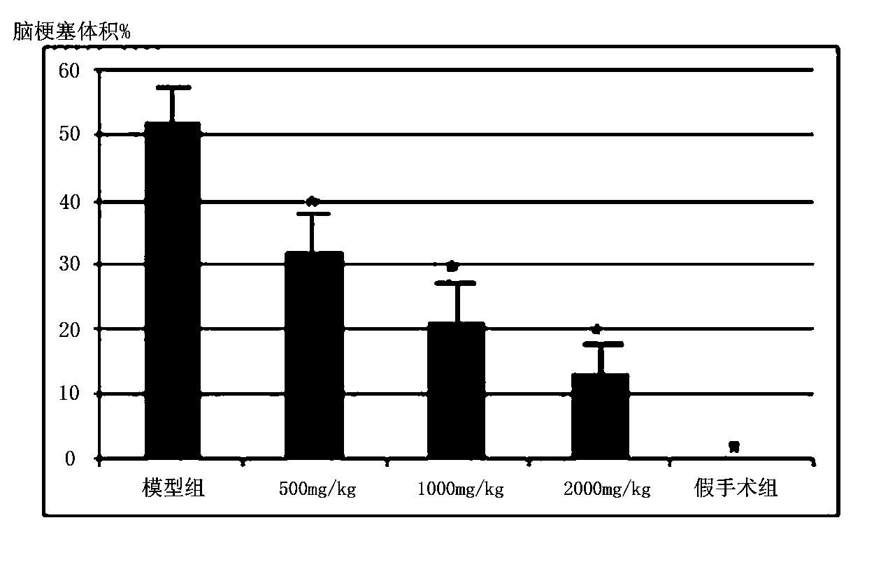 Hilicidum injection for preventing and treating ischemic cardiovascular and cerebrovascular diseases as well as preparation method and application thereof