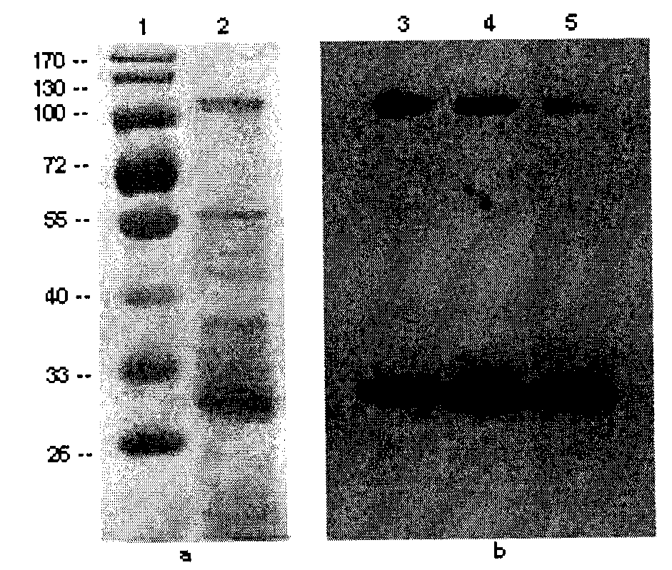 Protein adhered to surface layers of bacteria and application thereof