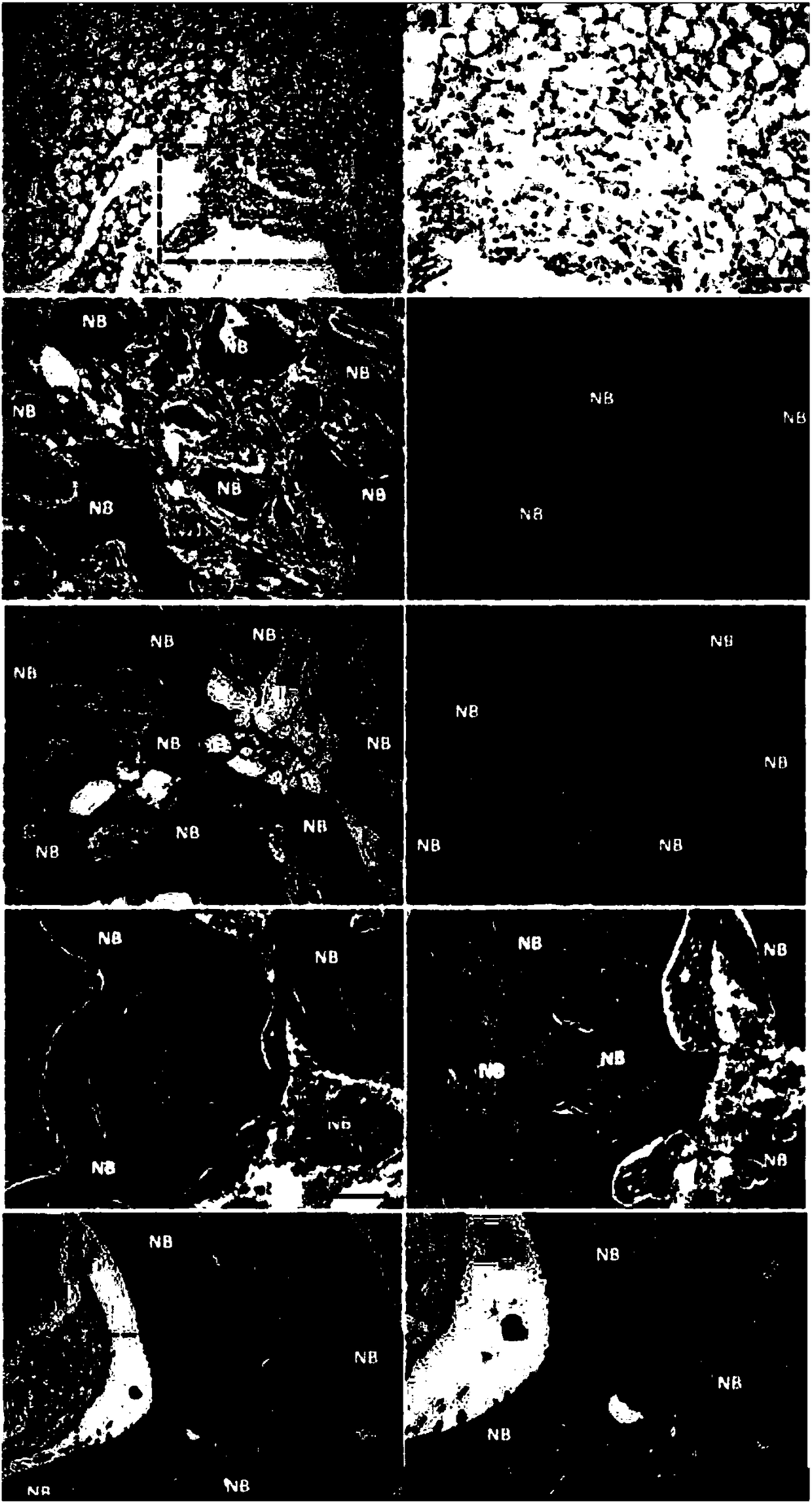 Vascularization-promoting bone-tissue engineering stent and preparation method and application thereof