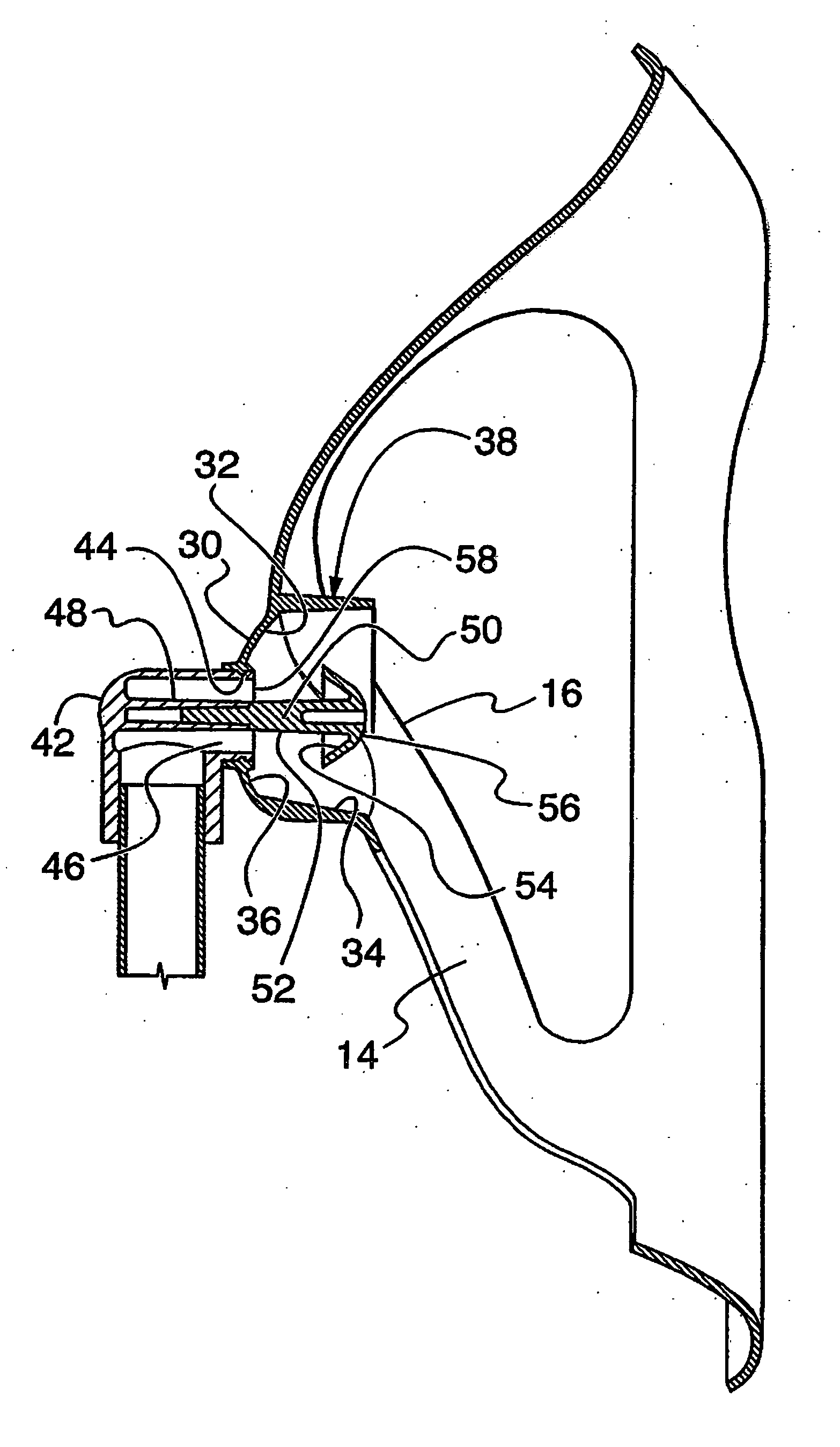 Patient oxygen delivery mask