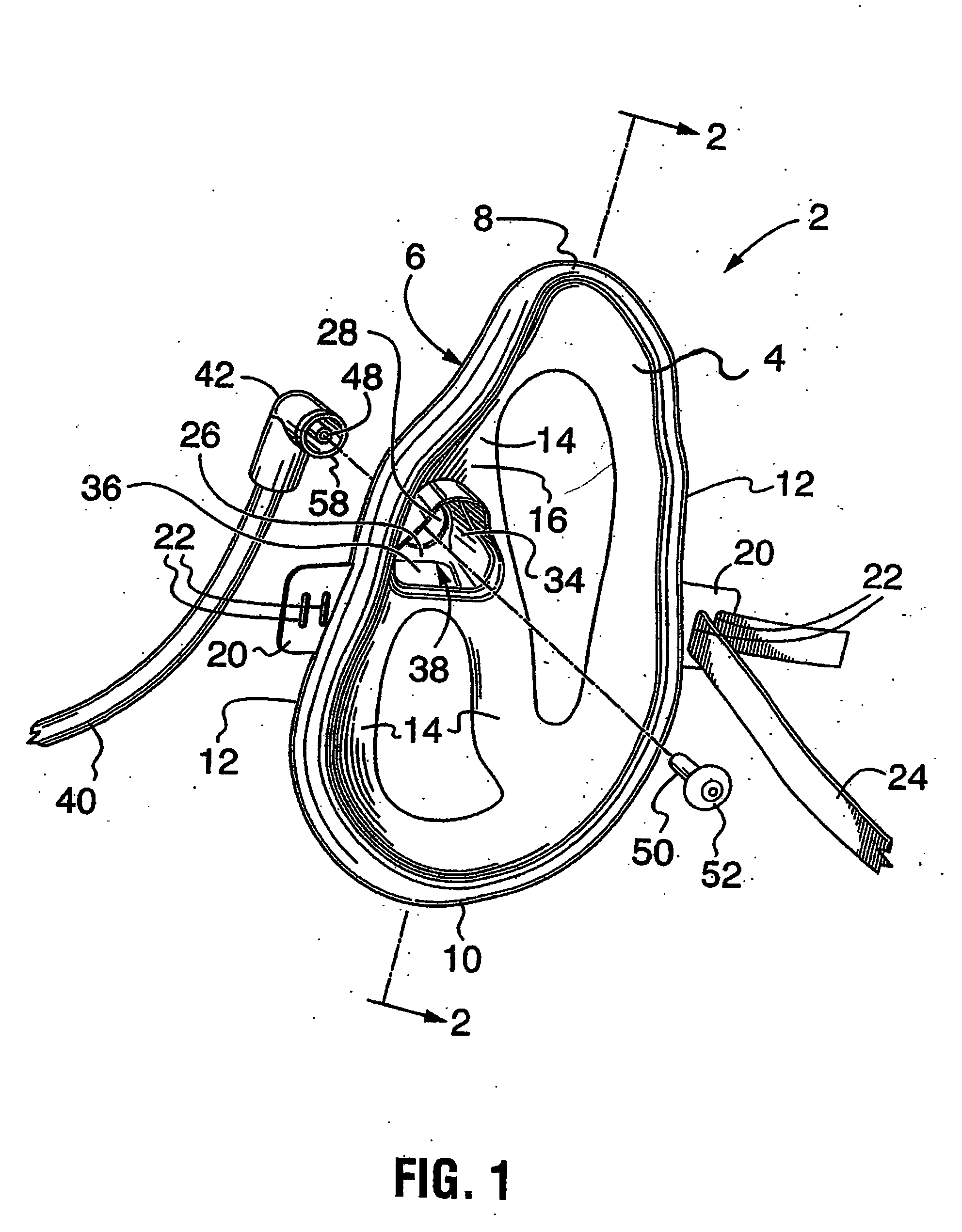 Patient oxygen delivery mask