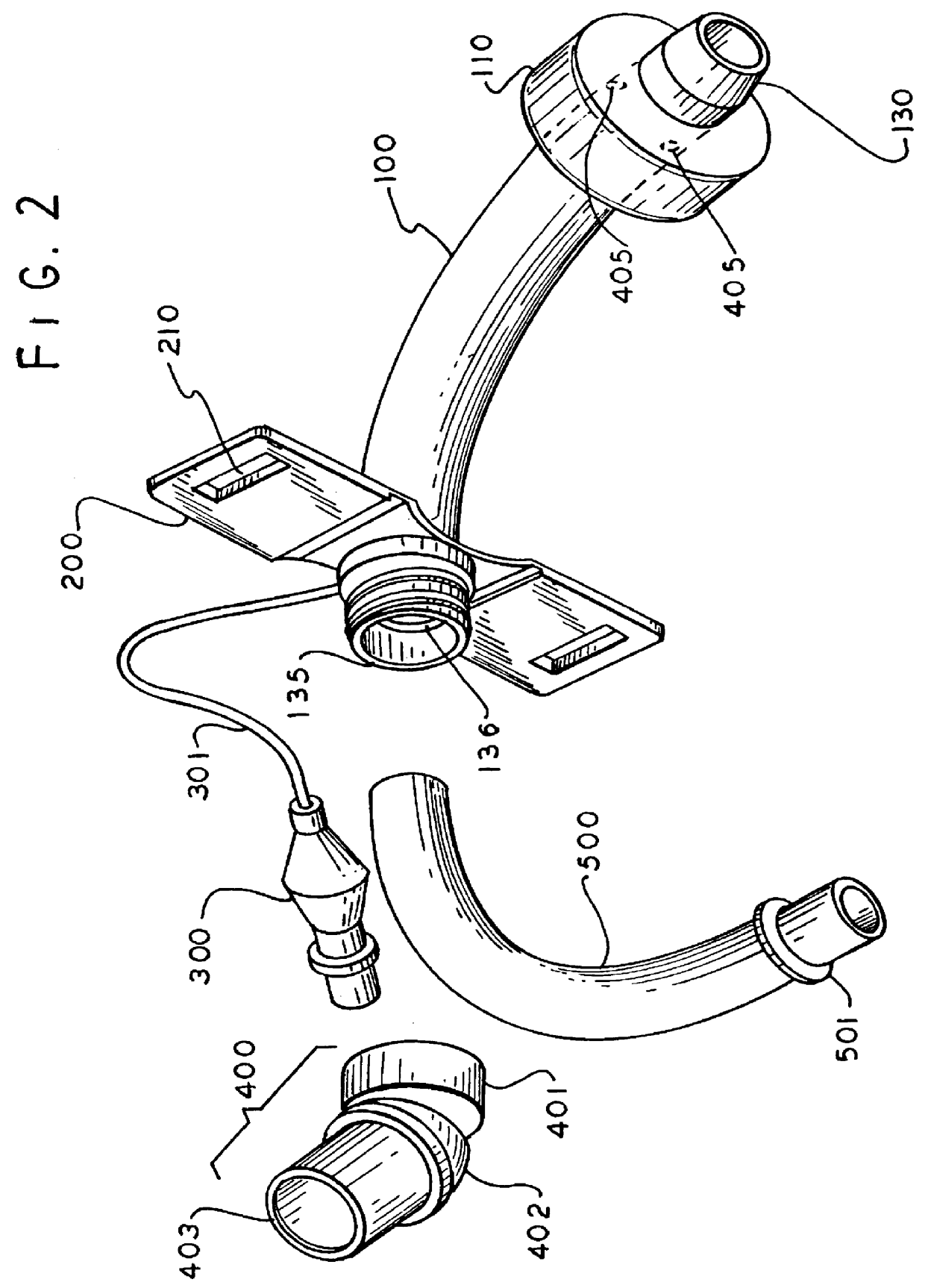 Tracheostomy tube with removable inner cannula