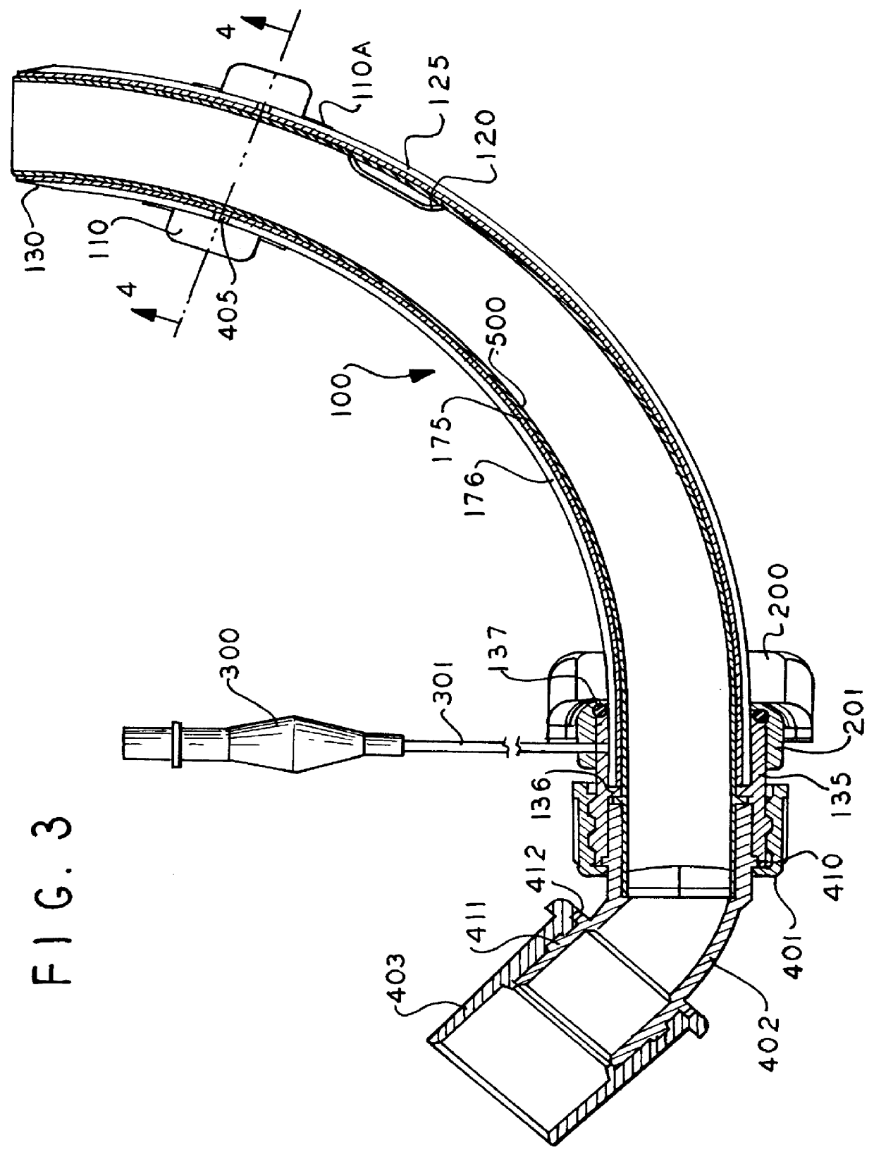 Tracheostomy tube with removable inner cannula