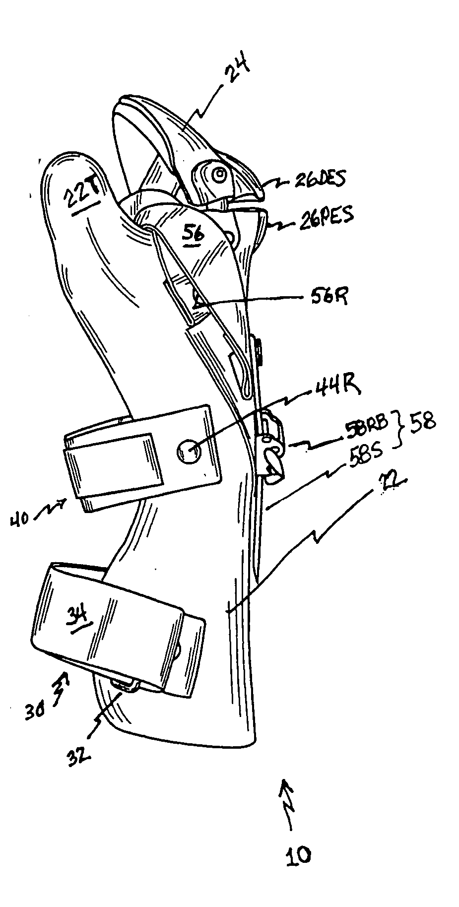 Forelimb brace device